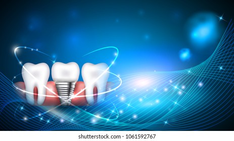 Dental implant and healthy teeth scientific modern design on a beautiful glowing background