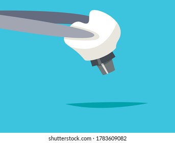 Dental Implant holding in forceps. Flat Vector Illustration in cartoon style.