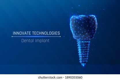 Dental Implant and Human teeth, Dental Healthy, Tooth Inside Medical health science. .Dentistry innovation future technology titan metal thread. wireframe. vector illustration.
Low poly. plexus