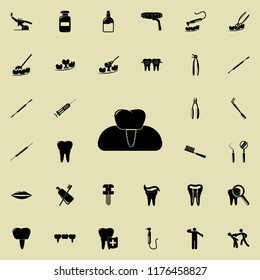 dental implant icon. Detailed set of Dental icons. Premium quality graphic design sign. One of the collection icons for websites, web design, mobile app