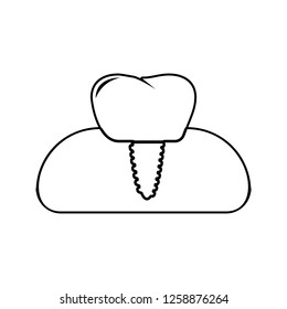 dental implant icon. Element of cyber security for mobile concept and web apps icon. Thin line icon for website design and development, app development