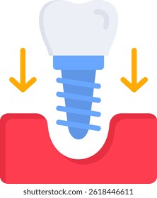 Dental Implant Icon Flat Vector Illustration