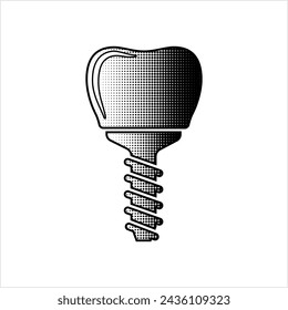 Dental Implant Icon, Tooth Endosseous Implant, Fixture Vector Art Illustration