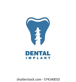 dental implant logo