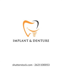 Dental implant logo .denture smile teeth care clinic vector. modern dentistry center design template