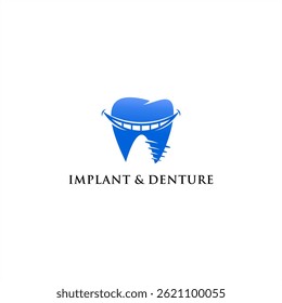 Dental implant logo .denture smile teeth care clinic vector. modern dentistry center design template