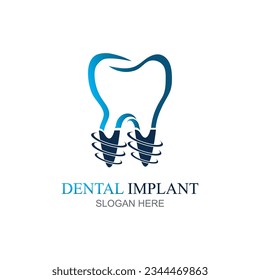Dental implant logo design concept vector, Dental Care logo template