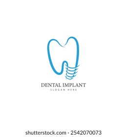 dental implant logo design concept vector  dental care logo template