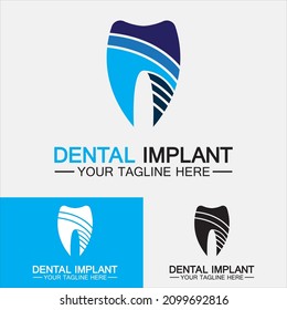 Dental implant logo vector  designs concept ,Dental Clinic logo,Dental Care logo template