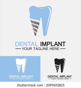 Dental implant logo vector  designs concept ,Dental Clinic logo,Dental Care logo template