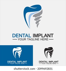 Dental implant logo vector  designs concept ,Dental Clinic logo,Dental Care logo template