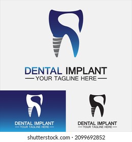 Dental implant logo vector  designs concept ,Dental Clinic logo,Dental Care logo template