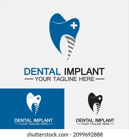 Dental implant logo vector  designs concept ,Dental Clinic logo,Dental Care logo template