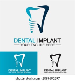 Diseño de vectores de logo de implantes dentales, logotipo de Clínica dental, plantilla de logotipo de cuidado dental