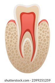 Dental implant. Medical educative infographic poster. Teeth implant, realistic vector design of dentistry. Healthcare, dentist and orthodontist treatment