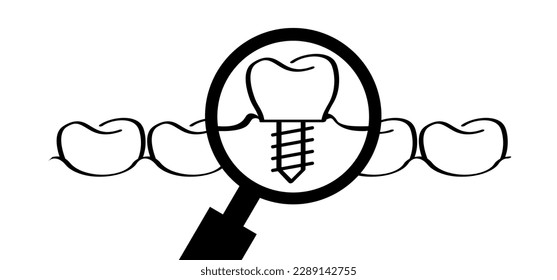 Dental implant, medically accurate or dental bridge. Cartoon healthy, tooth with gums. Molar line pattern. Drawing tooth with screw. Damage teeth or tooth with caries. Surgery jaw, medicine screw.