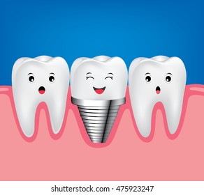 Dental implant and normal tooth beautiful bright.  Smiling screw tooth. Funny  illustration