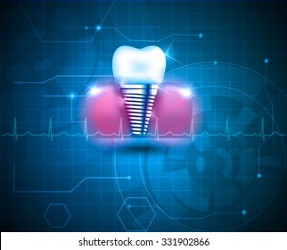 Dental implant on a beautiful bright technology background.