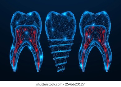 Zahnimplantat. Polygonales Design von miteinander verbundenen Linien und Punkten. Blauer Hintergrund.
