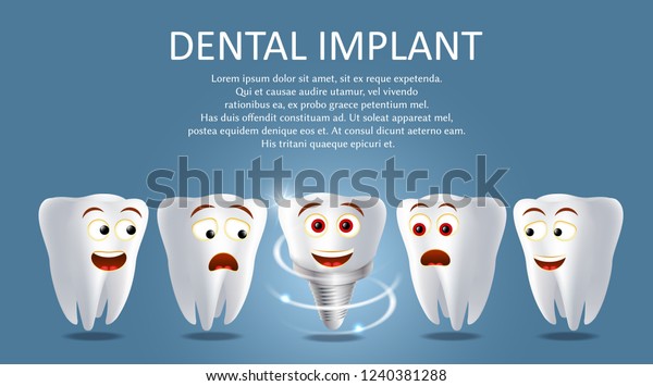 歯科用インプラントポスターバナーテンプレート ベクター画像のリアルなイラスト 健康な人の歯と歯のプロテーゼ 歯の修復の置き換えのコンセプト のベクター画像素材 ロイヤリティフリー