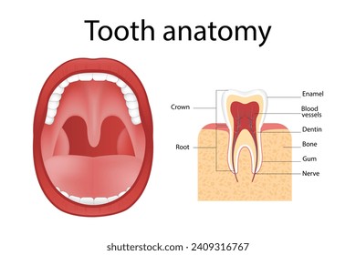 Dental implant. Realistic implant structure, graphic models of the crown. Screw prosthesis, orthodontic dental implantation