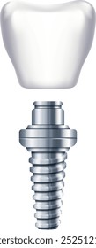 Dental implant scheme. Tooth replacement. Orthodontic illustration