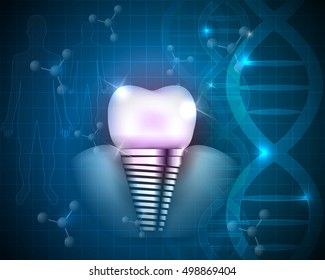 Dental implant scientific design on a blue DNA background.