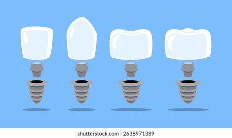 Dental implant structure . Crown, abutment, screw and fixture . Tooth cartoon illustration . Isolated on blue background . Vector .