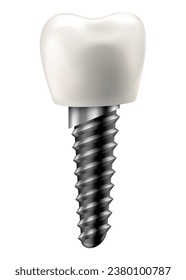 Estructura del implante dental. Afiche de infografía educativa médica. Implante de dientes, diseño vectorial realista de la odontología. Tornillo de Implante, asistencia sanitaria, tratamiento odontológico y ortodoncista