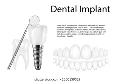 Implante dentário estrutura médica pictórico educativo infográfico cartaz com substituição molar fim ferramentas saudáveis modelos ilustração vetorial.