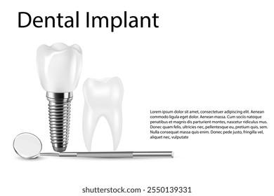 Implante dentário estrutura médica pictórico educativo infográfico cartaz com substituição molar fim ferramentas saudáveis modelos ilustração vetorial.