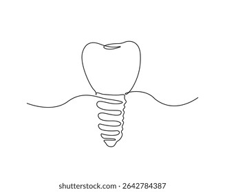 Dental implant structure outline illustration. Continuous line drawing of dental implant.