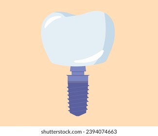 Dental implant teeth healthcare dentist and orthodontist treatment	
