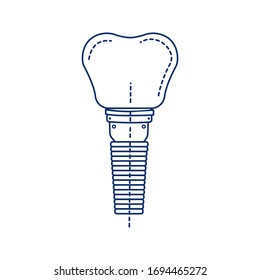 Dental implant tooth black line icon. Metal post that replaces the root portion of a missing tooth. Pictogram for web page, mobile app, promo. UI UX GUI design element. Editable stroke.