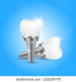 Dental implant and tooth for stomatology. Implant structure models. Screw denture orthodontic implantation. stomatology clinic concept. Realistic isolated 3D vector ​illustration.