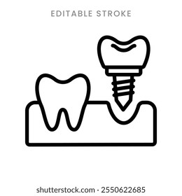 Dental implant treatment icon vector. Teeth implants surgery procedure symbol outline icon. Editable stroke