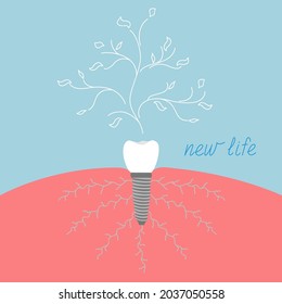 Dental implant as a tree