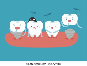 dental implant vector