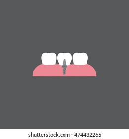 dental implant vector icon