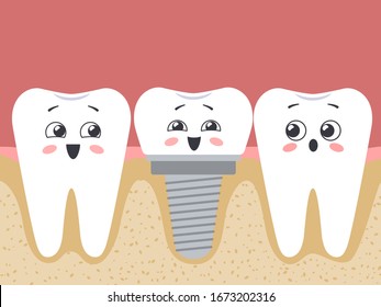 Dental implantation. A prosthesis among ordinary teeth. Vector illustration. Vector illustration