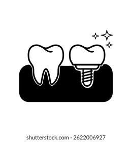 Dental implantation, Tooth restoration symbol, Dental care. Vector illustration design