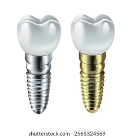 Dental implants. 3D model. Isolated on white background. Vector illustration