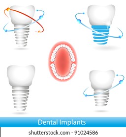 Dental implants. Beautiful bright colors