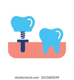 Dental implants icons, minimalist vector illustration and transparent graphic element. Isolated on white background