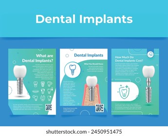 Implantes dentales infografía información bolsillo póster diseño conjunto de Plantilla Ilustración vectorial. Odontología Estomatología Dientes artificiales Reemplaza la estructura Tecnología de ortodoncia Promo médico