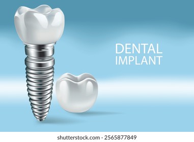 Dental implants on a light blue background, Vector illustration