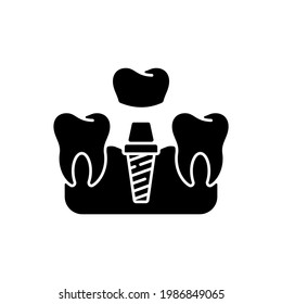 Dental implants procedure black glyph icon. Tooth recovery process. Dental surgety. Proffesional cosmetics stomatology. Silhouette symbol on white space. Vector isolated illustration