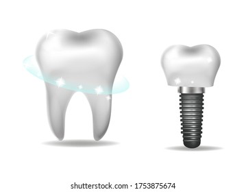 Dental implants, prosthetics 3D realistic style. Dentistry, healthy teeth concept. Vector illustration