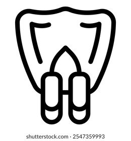 Implantes dentales que muestran gingivitis y periodontitis conectados por puente con parodontitis visible