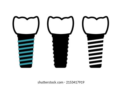 Dental implants surgery concept. Anatomical poster with human teeth. Prosthesis in mouth. Crown abutment and screw medical poster isolated flat vector illustration for clinic or education. .